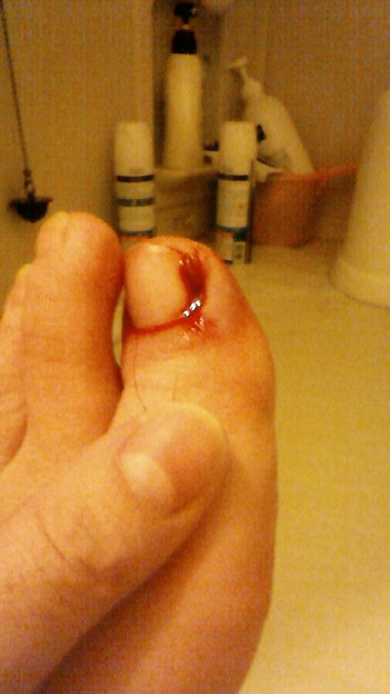 閲覧注意 イェアアアア 写真共有サイト フォト蔵